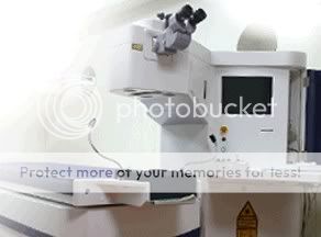 LASIK,近視雷射,無刀近視雷射,近視,眼科,白內障,前導波,角膜塑型術,虹膜定位,飛秒雷射
